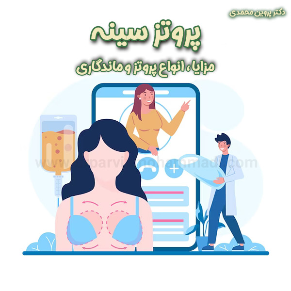 پروتز سینه - دکتر پروین محمدی