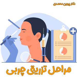 تزریق چربی - دکتر پروین محمدی
