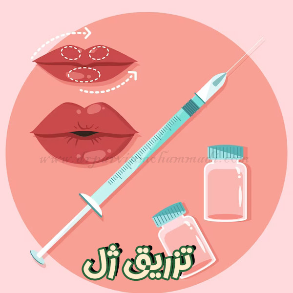 تزریق ژل - دکتر پروین محمدی