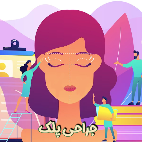 جراحی پلک - دکتر پروین محمدی