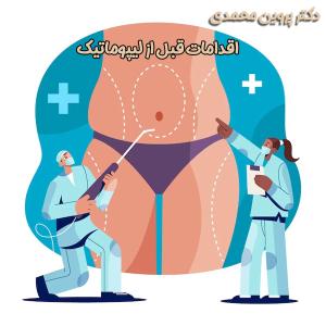 لیپوماتیک - دکتر پروین محمدی