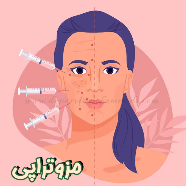 مزوتراپی - دکتر پروین محمدی