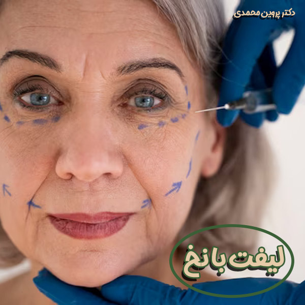 لیفت با نخ در اهواز - دکتر پروین محمدی