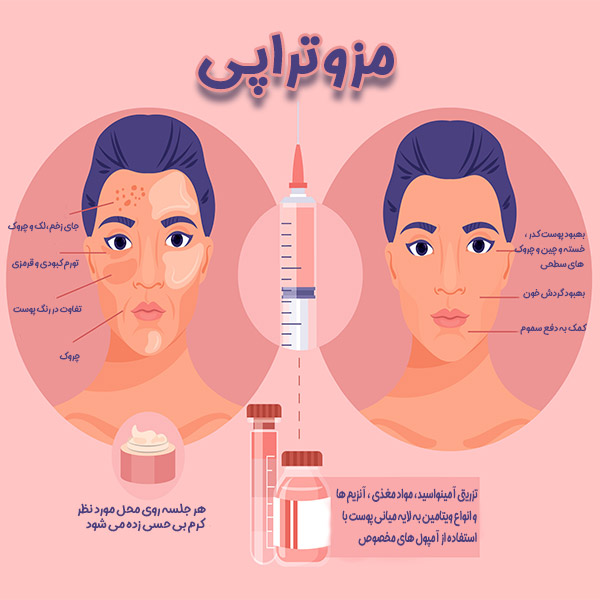 مزوتراپی - دکتر پروین محمدی
