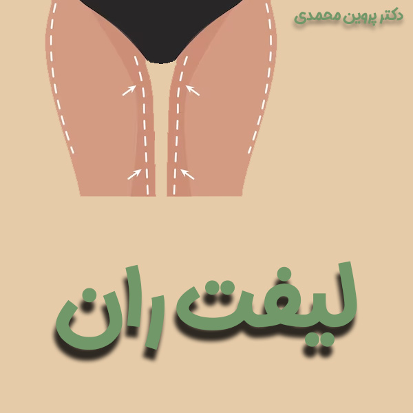 لیفت ران - دکتر پروین محمدی