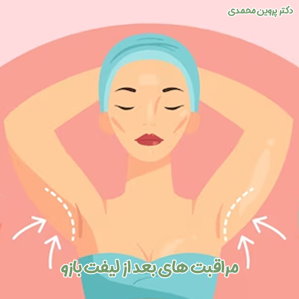مراقبت های بعد از لیفت بازو - پروین محمدی