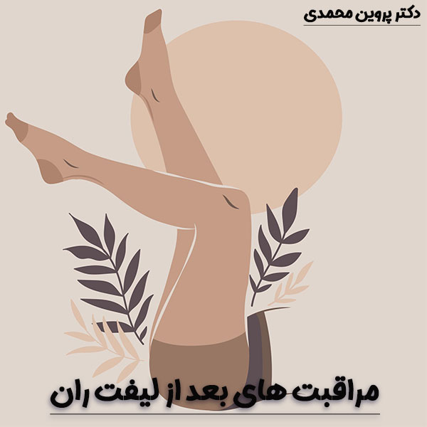 مراقبت های بعد از لیفت ران_دکتر پروین محمدی