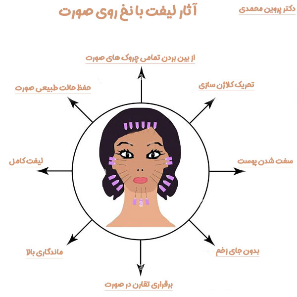 لیفت با نخ - دکتر پروین محمدی