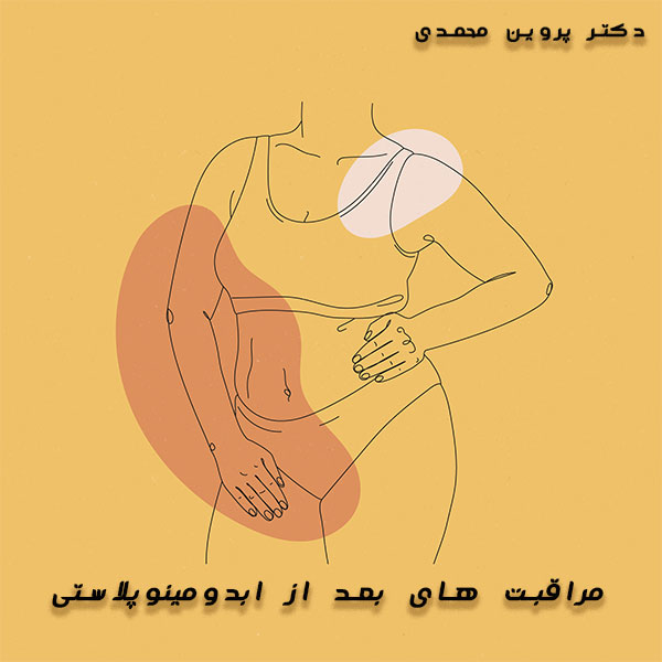 مراقبت های بعد از ابدومینوپلاستی - دکتر پروین محمدی