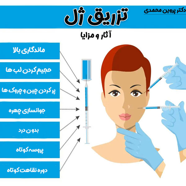 تزریق ژل در اهواز -دکتر پروین محمدی