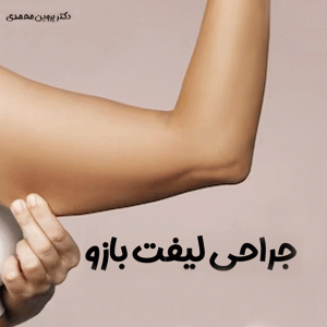 جراحی لیفت بازو